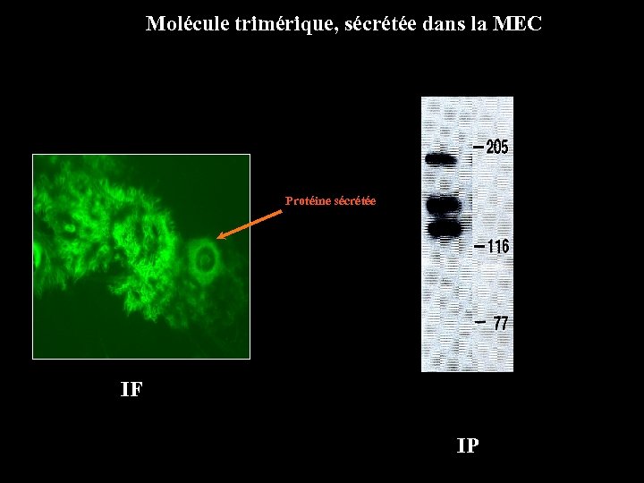 Molécule trimérique, sécrétée dans la MEC Protéine sécrétée IF IP 