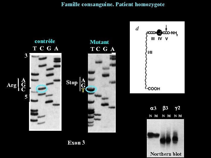 Famille consanguine. Patient homozygote contrôle T C G A Mutant T C G A