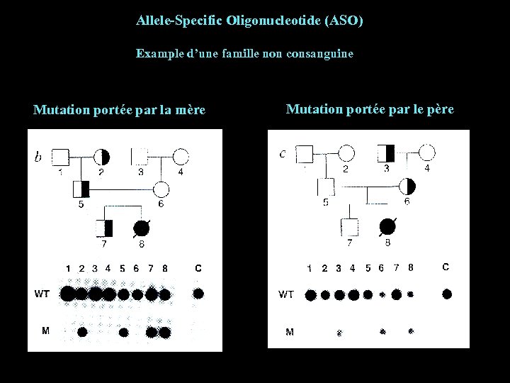 Allele-Specific Oligonucleotide (ASO) Example d’une famille non consanguine Mutation portée par la mère Mutation