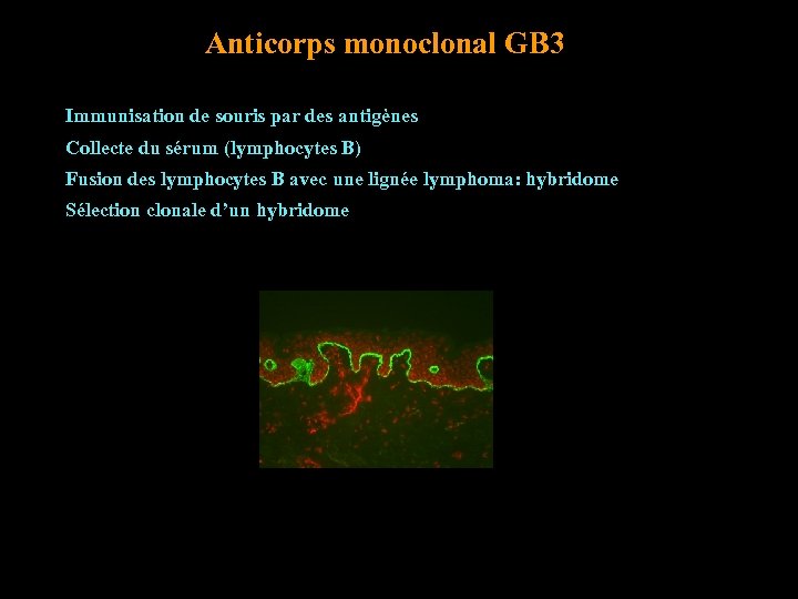 Anticorps monoclonal GB 3 Immunisation de souris par des antigènes Collecte du sérum (lymphocytes