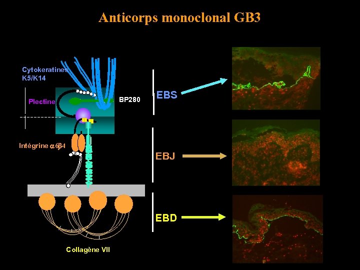 Anticorps monoclonal GB 3 Cytokeratines K 5/K 14 BP 280 Plectine EBS Intégrine 6