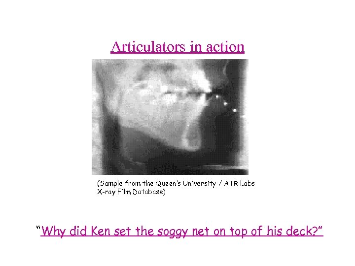 Articulators in action (Sample from the Queen’s University / ATR Labs X-ray Film Database)