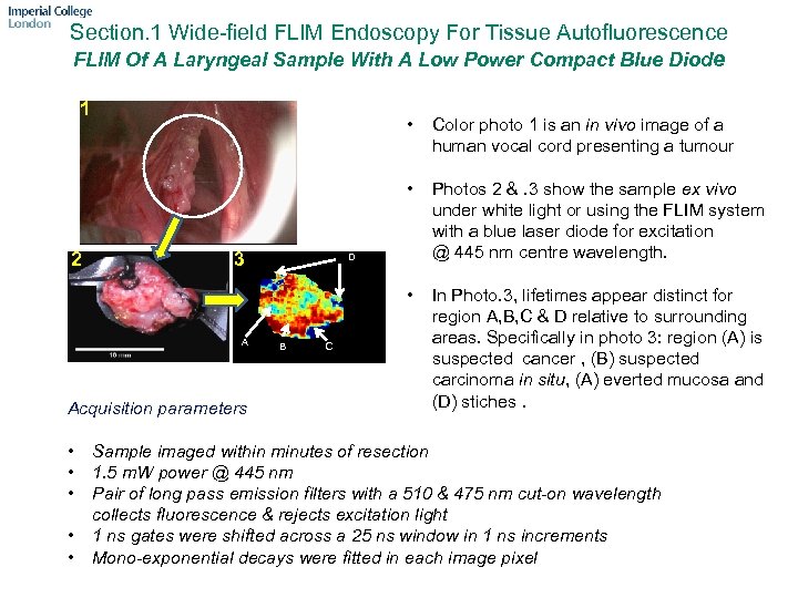 Section. 1 Wide-field FLIM Endoscopy For Tissue Autofluorescence FLIM Of A Laryngeal Sample With