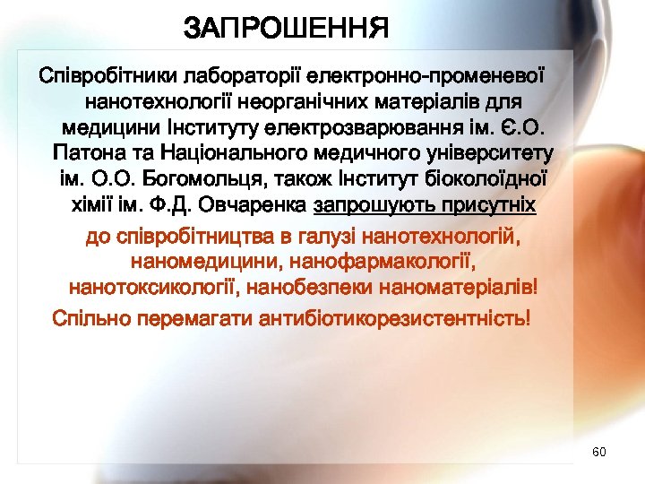 ЗАПРОШЕННЯ Співробітники лабораторії електронно-променевої нанотехнології неорганічних матеріалів для медицини Інституту електрозварювання ім. Є. О.