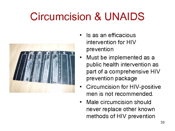 Circumcision & UNAIDS • Is as an efficacious intervention for HIV prevention • Must