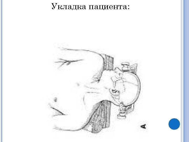 Укладка пациента: 