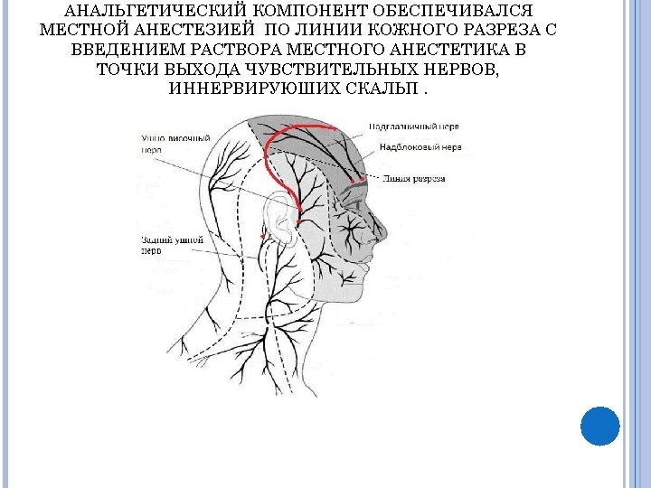 АНАЛЬГЕТИЧЕСКИЙ КОМПОНЕНТ ОБЕСПЕЧИВАЛСЯ МЕСТНОЙ АНЕСТЕЗИЕЙ ПО ЛИНИИ КОЖНОГО РАЗРЕЗА С ВВЕДЕНИЕМ РАСТВОРА МЕСТНОГО АНЕСТЕТИКА