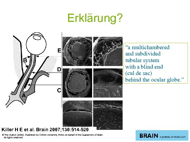 Erklärung? “a multichambered and subdivided tubular system with a blind end (cul de sac)