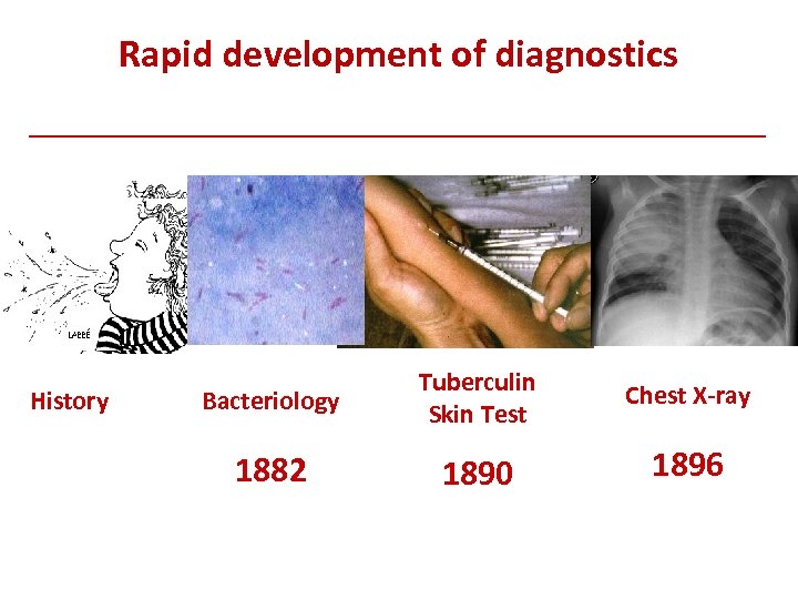 Rapid development of diagnostics History Bacteriology Tuberculin Skin Test Chest X-ray 1882 1890 1896