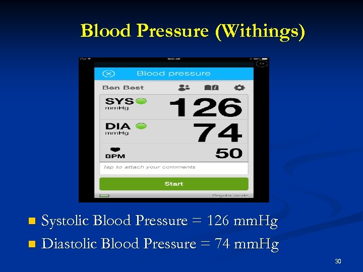 Blood Pressure (Withings) Systolic Blood Pressure = 126 mm. Hg n Diastolic Blood Pressure