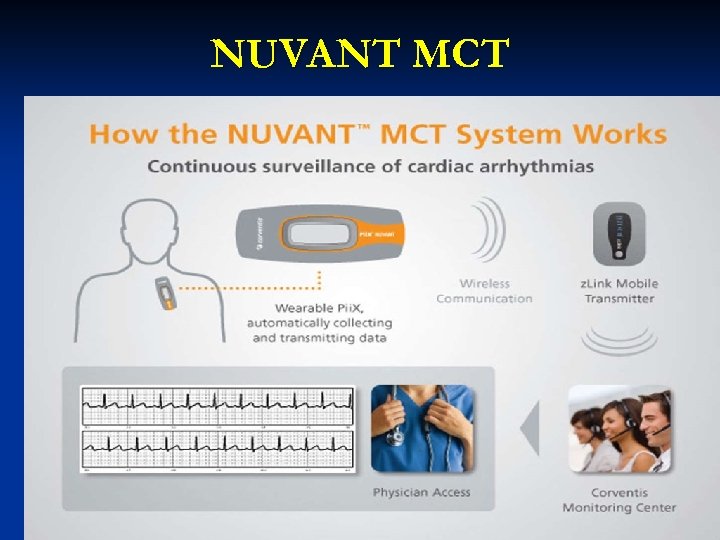 NUVANT MCT 43 