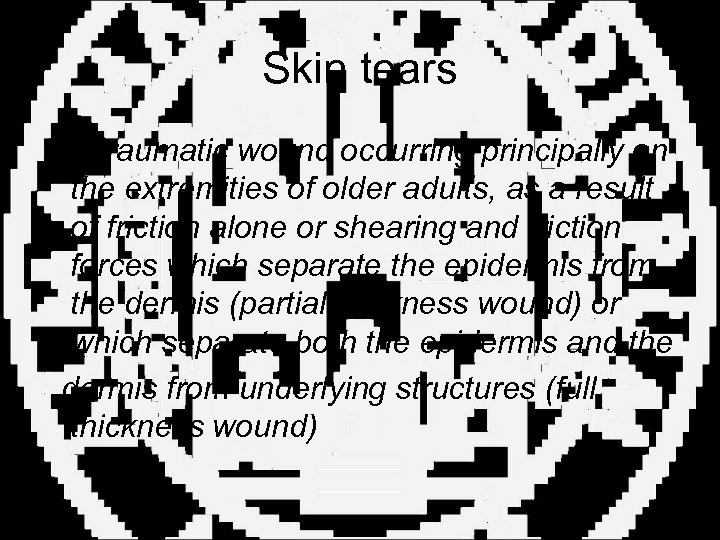 Skin tears • a traumatic wound occurring principally on the extremities of older adults,