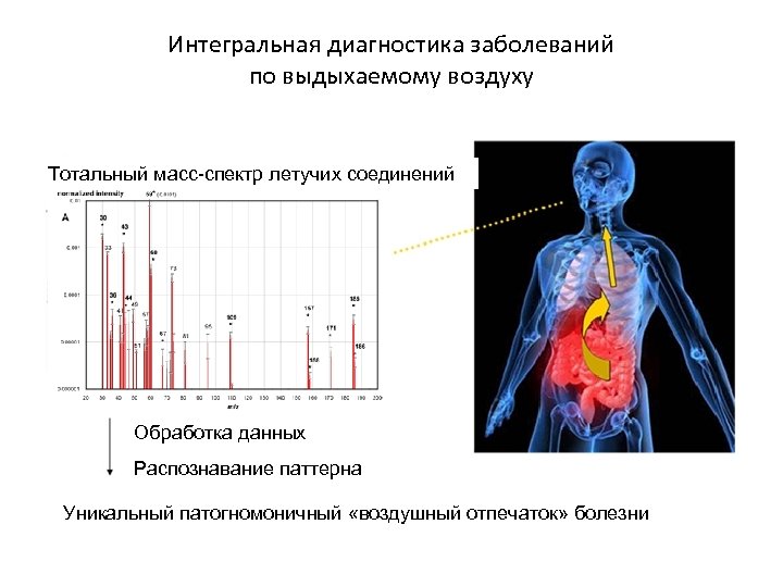 Интегральная диагностика заболеваний по выдыхаемому воздуху Тотальный масс-спектр летучих соединений Аэрограмма Обработка данных Распознавание