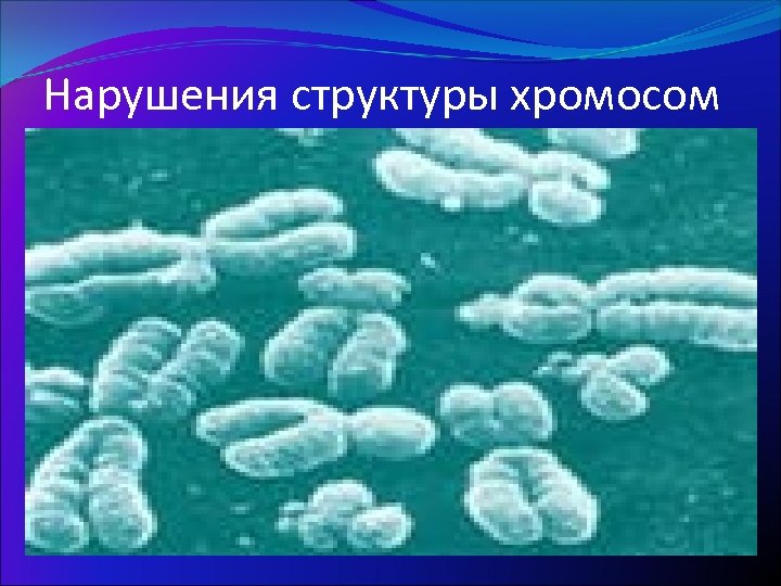 Нарушения структуры хромосом 