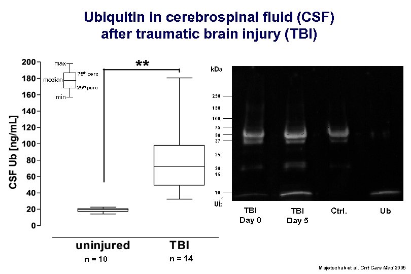 Ubiquitin in cerebrospinal fluid (CSF) after traumatic brain injury (TBI) max median 75 th
