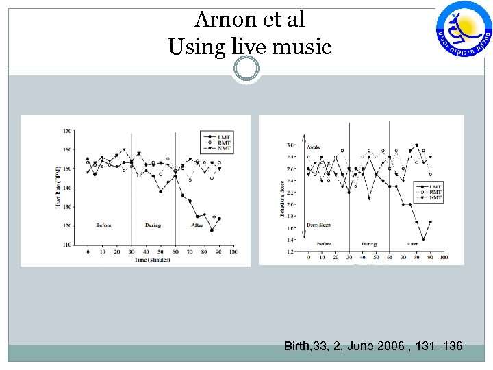 Arnon et al Using live music Birth, 33, 2, June 2006 , 131– 136