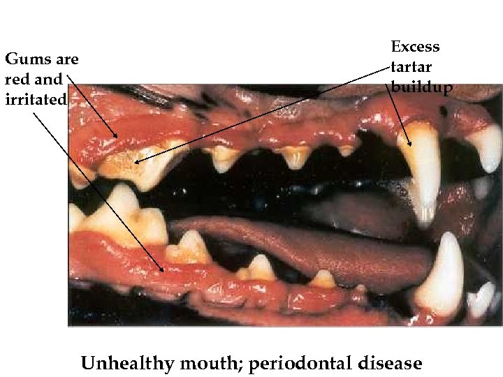Gums are red and irritated Excess tartar buildup Unhealthy mouth; periodontal disease 