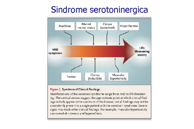 Sindrome serotoninergica 