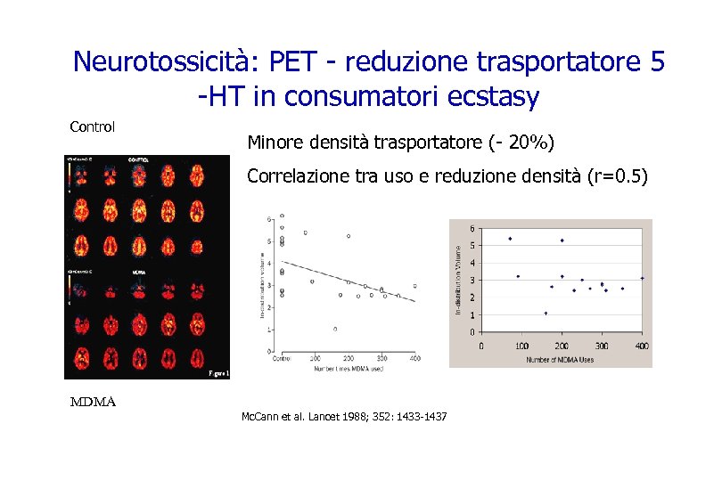 Neurotossicità: PET - reduzione trasportatore 5 -HT in consumatori ecstasy Control Minore densità trasportatore