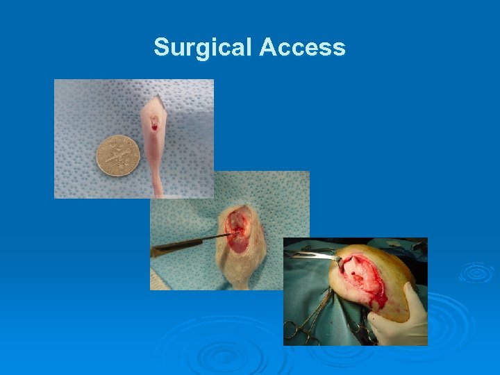 Surgical Access 