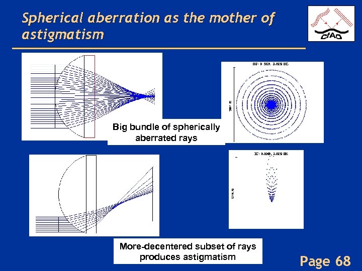 Spherical aberration as the mother of astigmatism Big bundle of spherically aberrated rays More-decentered