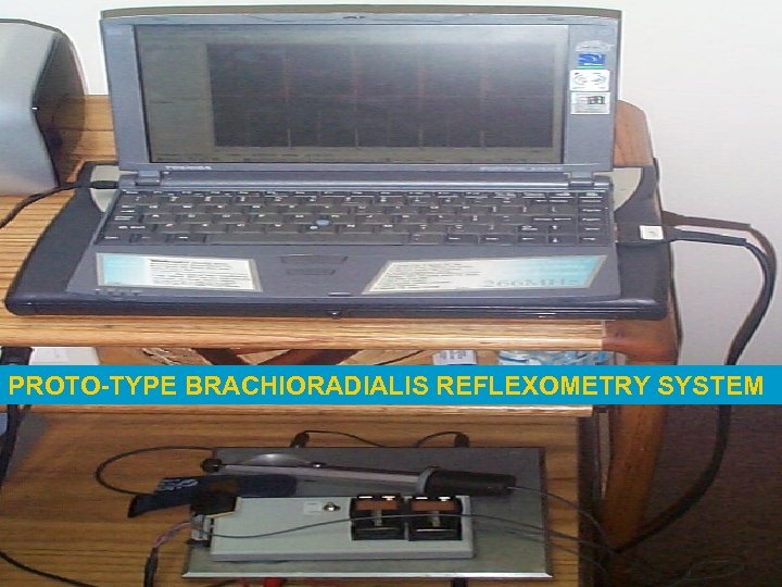 PROTO-TYPE BRACHIORADIALIS REFLEXOMETRY SYSTEM 