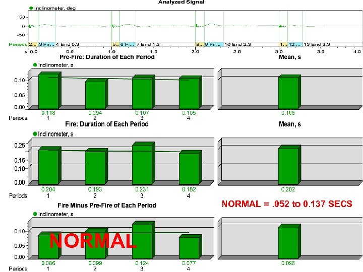 NORMAL =. 052 to 0. 137 SECS NORMAL 