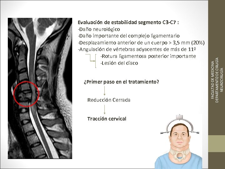 ¿Primer paso en el tratamiento? Reducción Cerrada Tracción cervical FACULTAD DE MEDICINA DEPARTAMENTO DE