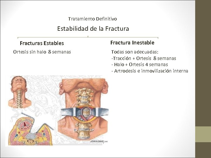 Tratamiento Definitivo Estabilidad de la Fracturas Estables Ortesis sin halo 8 semanas Fractura Inestable