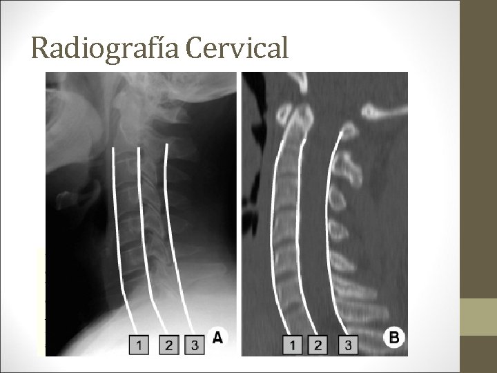 Radiografía Cervical 