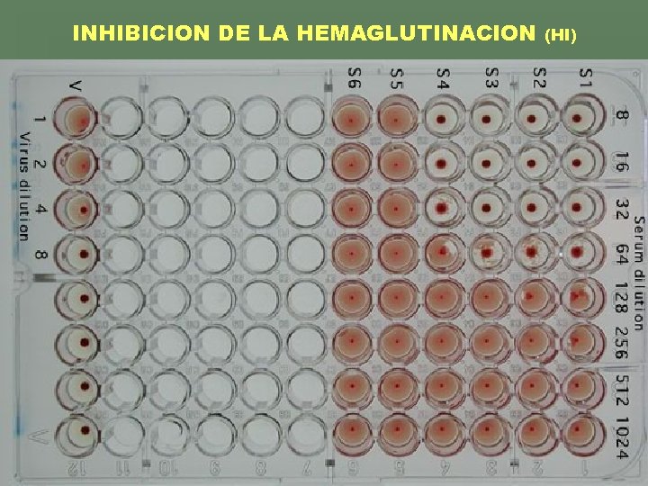 INHIBICION DE LA HEMAGLUTINACION (HI) 