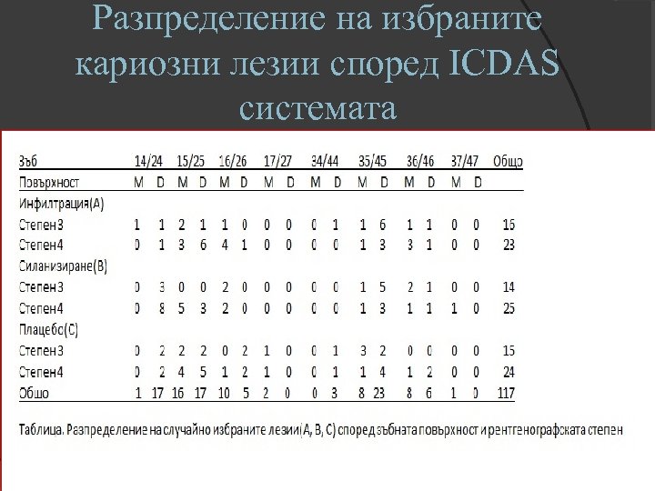 Разпределение на избраните кариозни лезии според ICDAS системата 