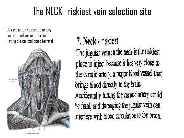 The NECK- riskiest vein selection site Lies close to the carotid arterymajor blood vessel