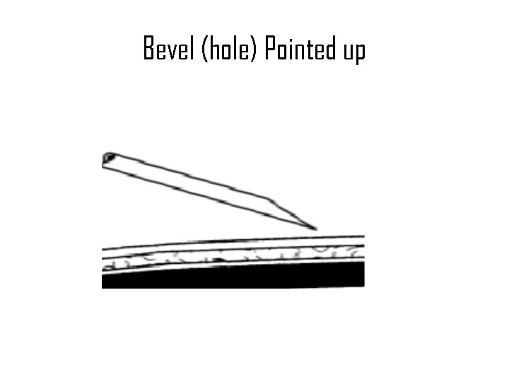 Bevel (hole) Pointed up 