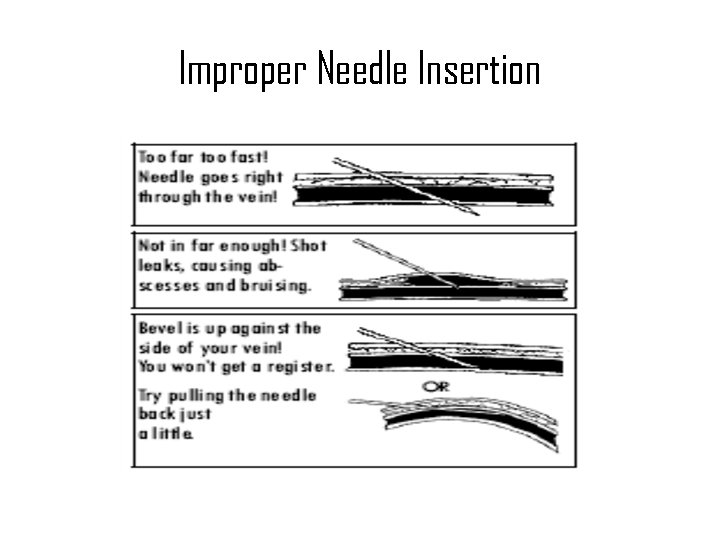 Improper Needle Insertion 