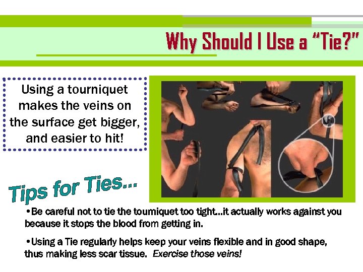 Why Should I Use a “Tie? ” Using a tourniquet makes the veins on