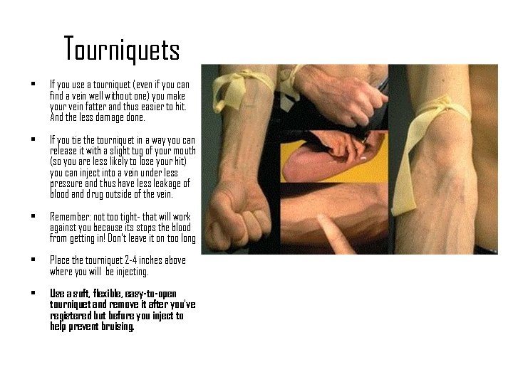 Tourniquets • If you use a tourniquet (even if you can find a vein