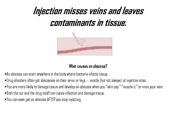 Injection misses veins and leaves contaminants in tissue. What causes an abscess? • An