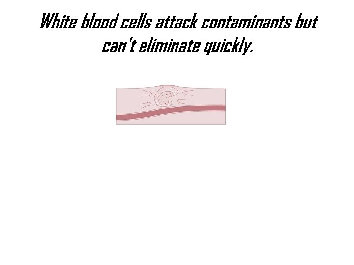 White blood cells attack contaminants but can't eliminate quickly. 