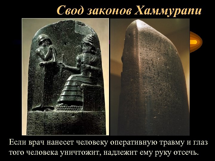 Свод законов Хаммурапи Если врач нанесет человеку оперативную травму и глаз того человека уничтожит,