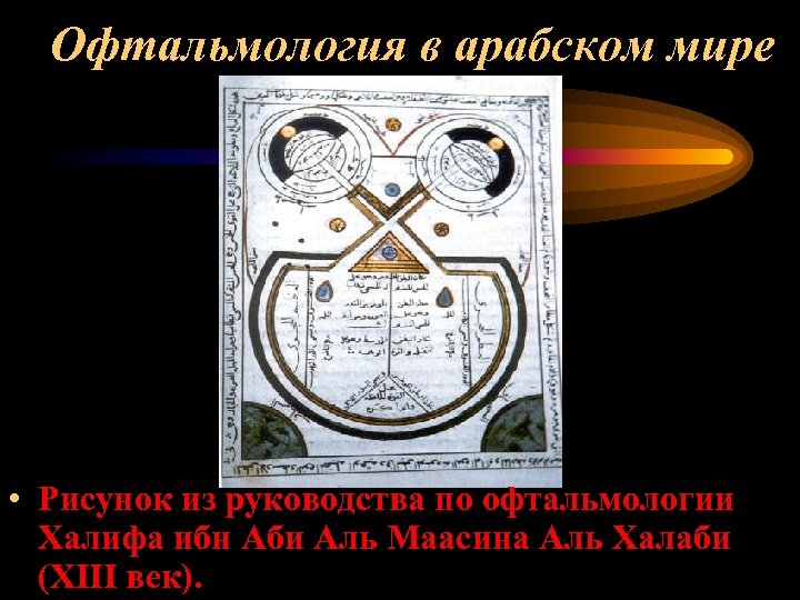 Офтальмология в арабском мире • Рисунок из руководства по офтальмологии Халифа ибн Аби Аль