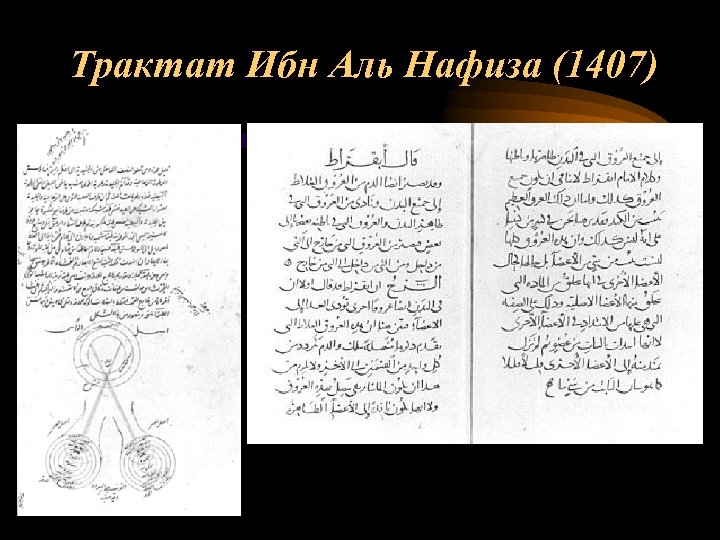 Трактат Ибн Аль Нафиза (1407) 