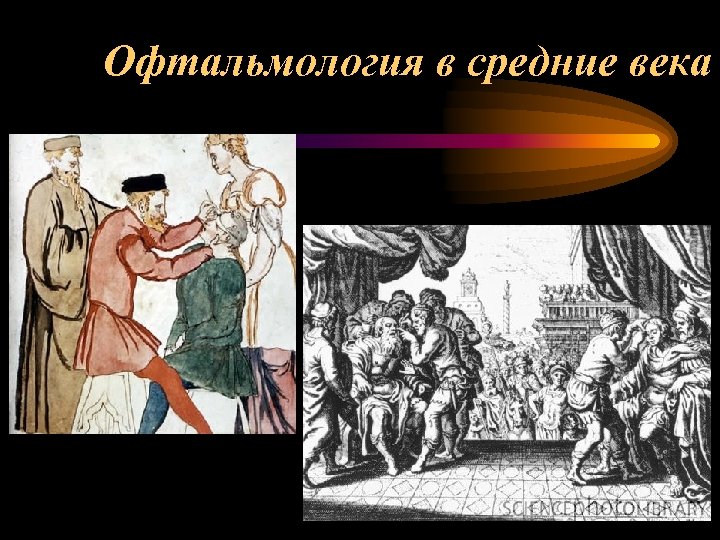 Офтальмология в средние века 
