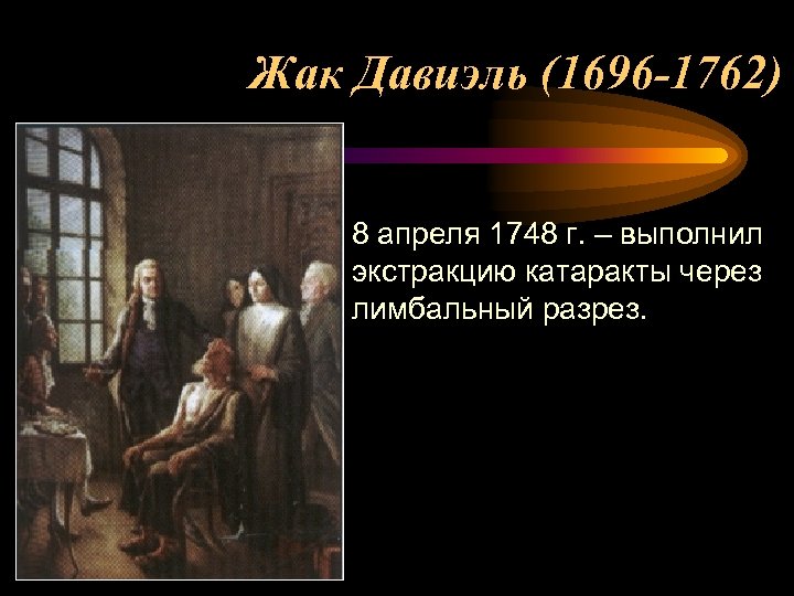Жак Давиэль (1696 -1762) 8 апреля 1748 г. – выполнил экстракцию катаракты через лимбальный