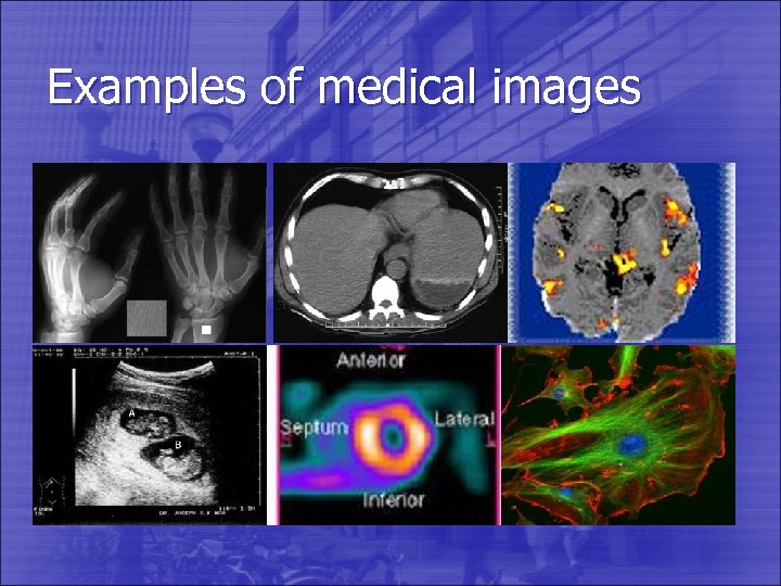 Examples of medical images 