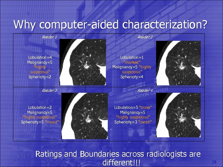Why computer-aided characterization? Reader 1 Reader 2 Lobulation=4 Malignancy=5 “highly suspicious” Sphericity=2 Lobulation=1 “marked”