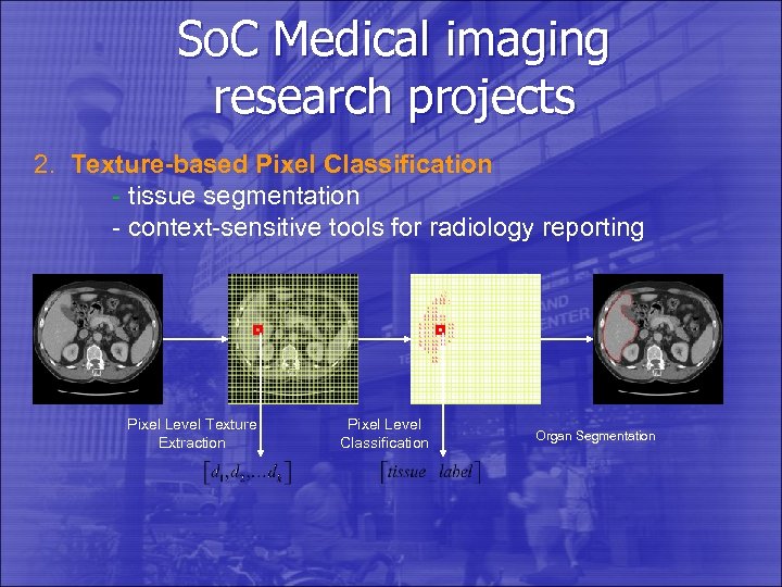 So. C Medical imaging research projects 2. Texture-based Pixel Classification - tissue segmentation -