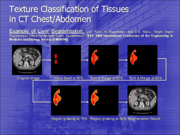 Texture Classification of Tissues in CT Chest/Abdomen Example of Liver Segmentation: (J. D. Furst,