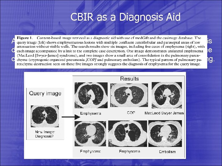 CBIR as a Diagnosis Aid An image retrieval system can help when the diagnosis