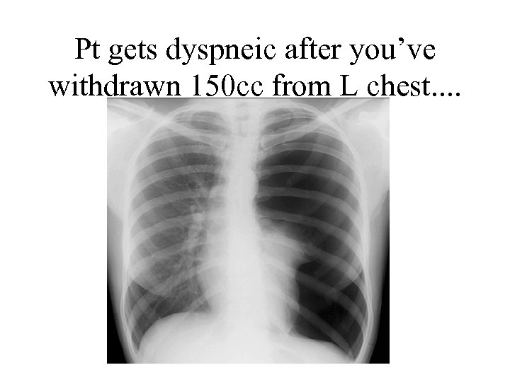 Pt gets dyspneic after you’ve withdrawn 150 cc from L chest. . 